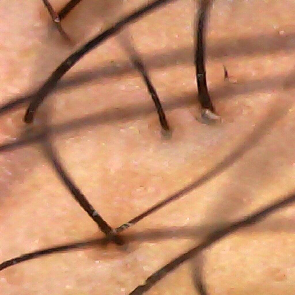 image5
