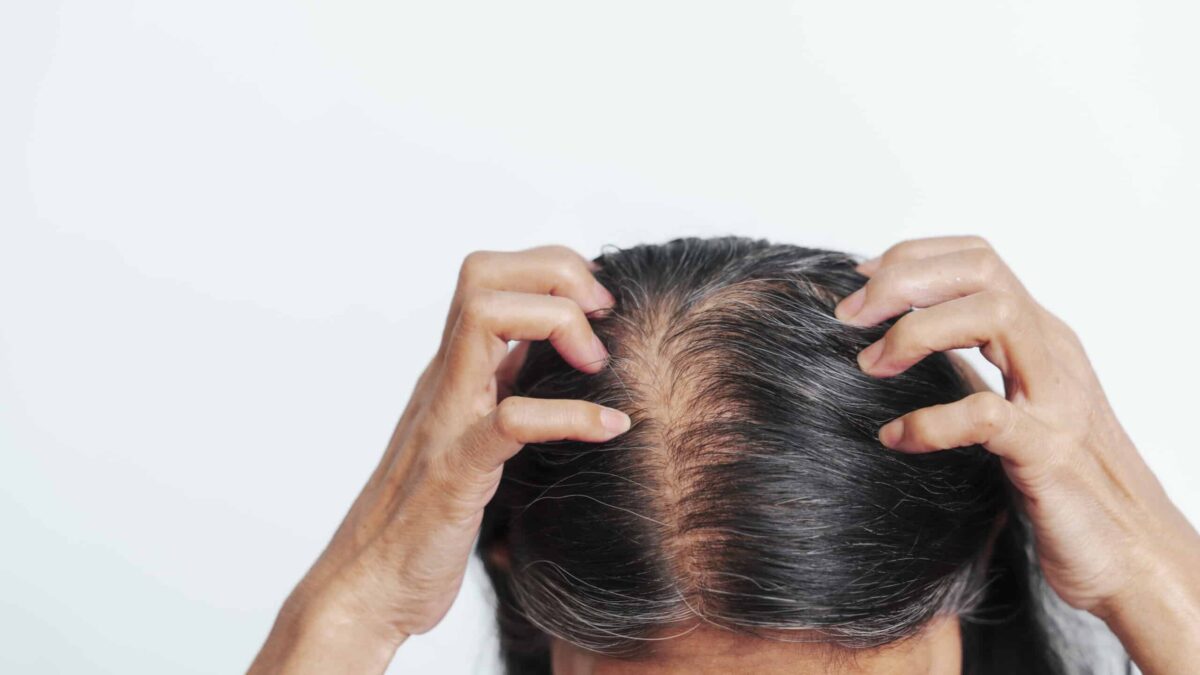 Close up older elderly asian chinese woman gray hair worry cance