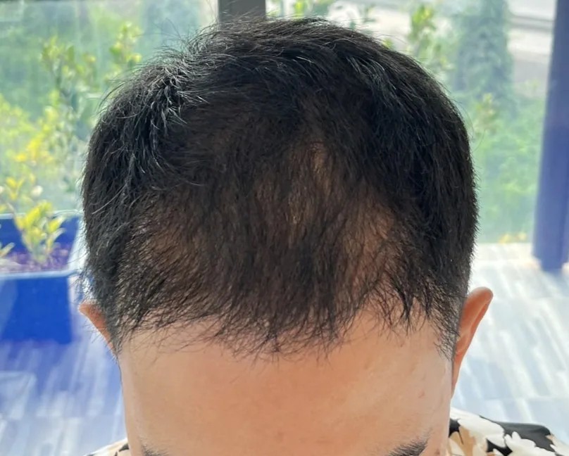 S__78962693_024535