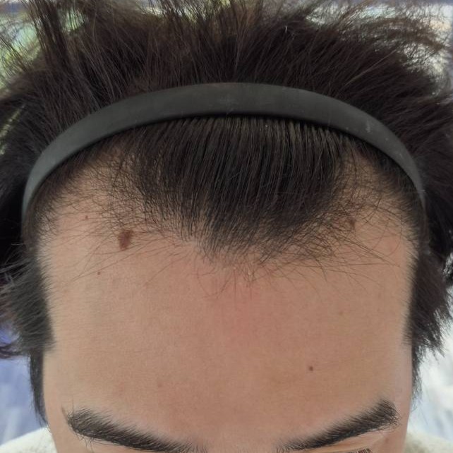 case01-khunb-01-before-2