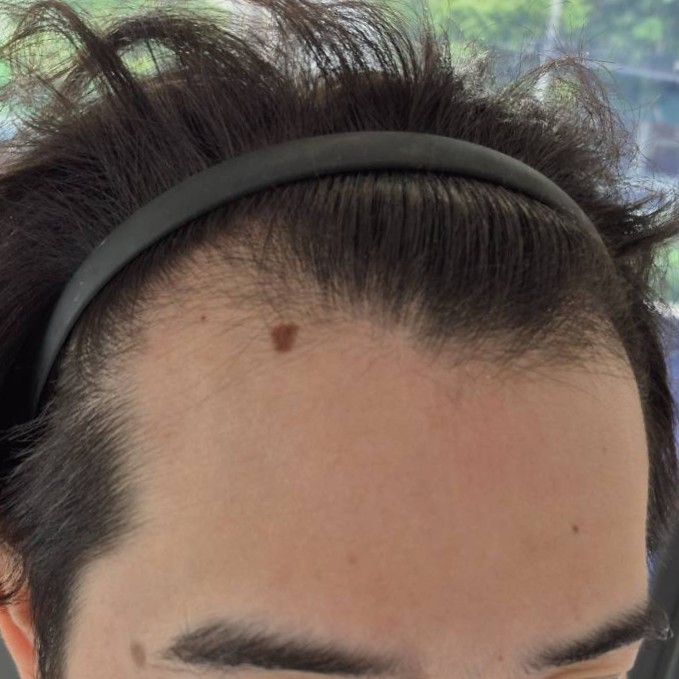 case01-khunb-01-before-3