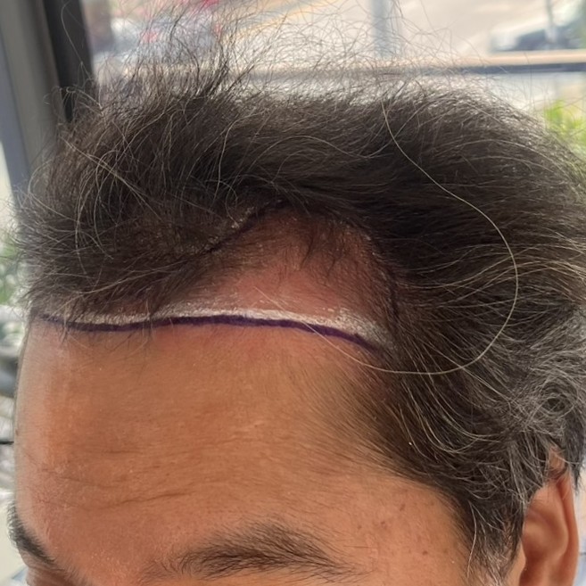 case02-khung-01-before-1