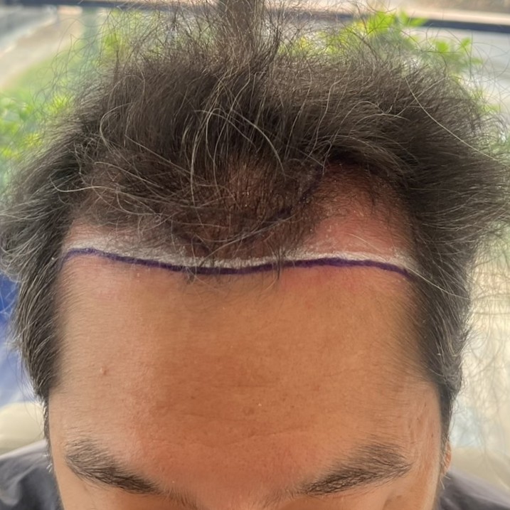 case02-khung-01-before-2