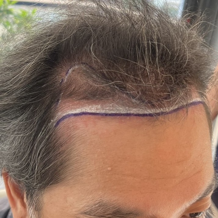 case02-khung-01-before-3