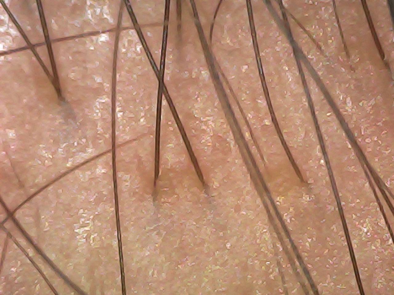 case02-khung-02-scope-before-1