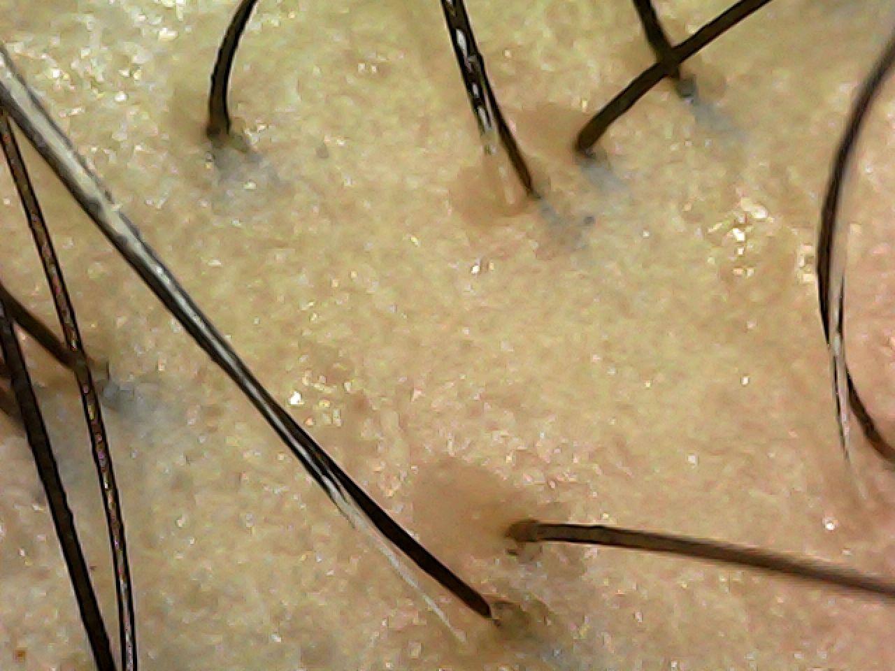 case02-khung-06-scope-after-1