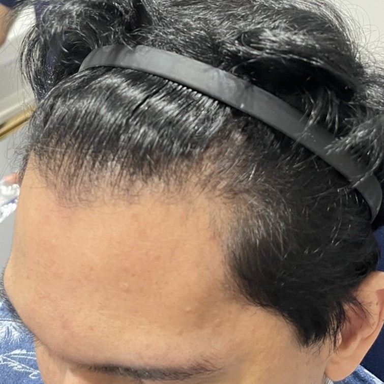 case03-khund-01-before-1