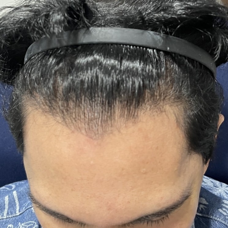 case03-khund-01-before-2