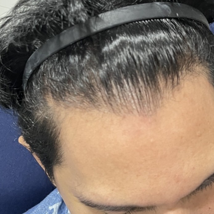 case03-khund-01-before-3