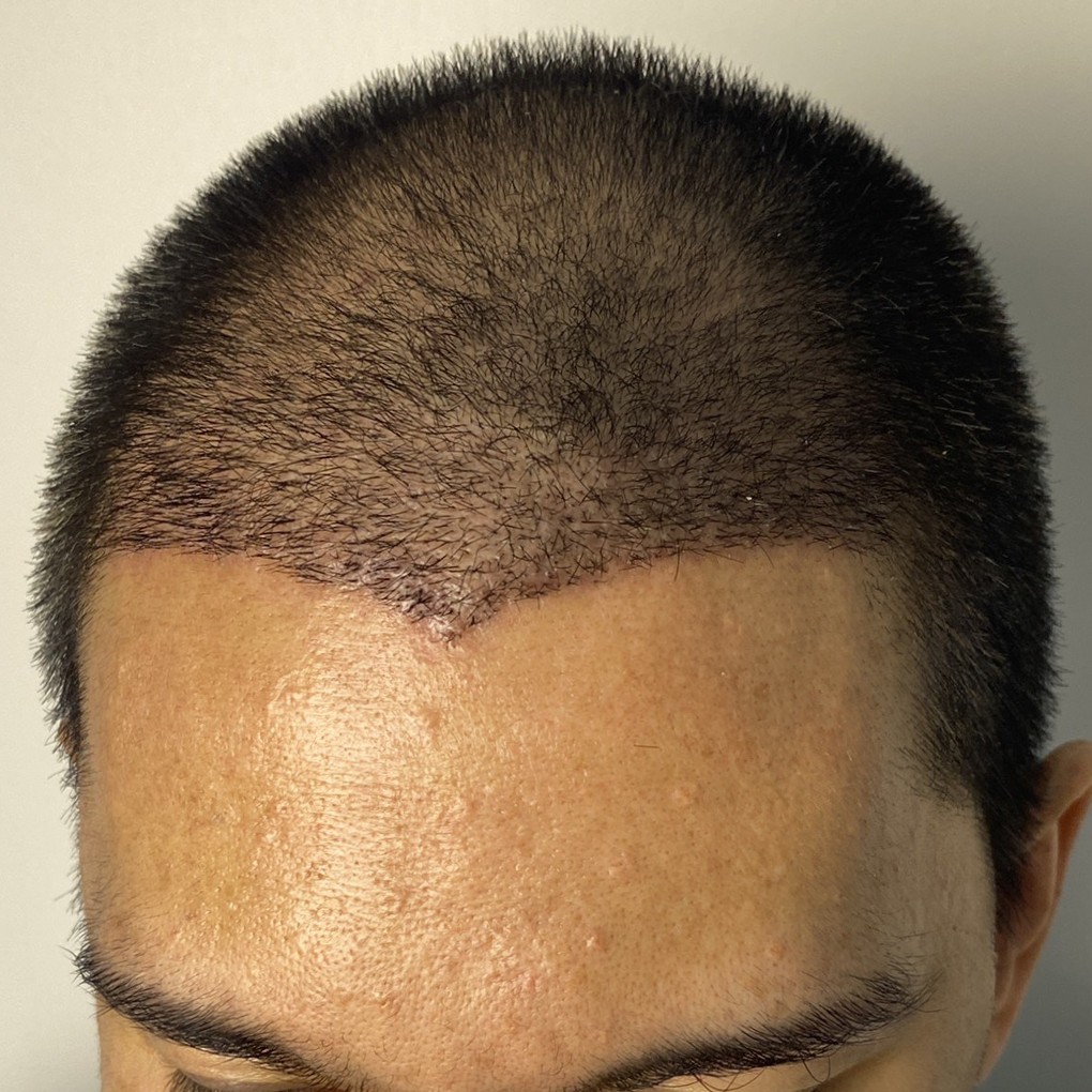 case03-khund-05-scope-after-1