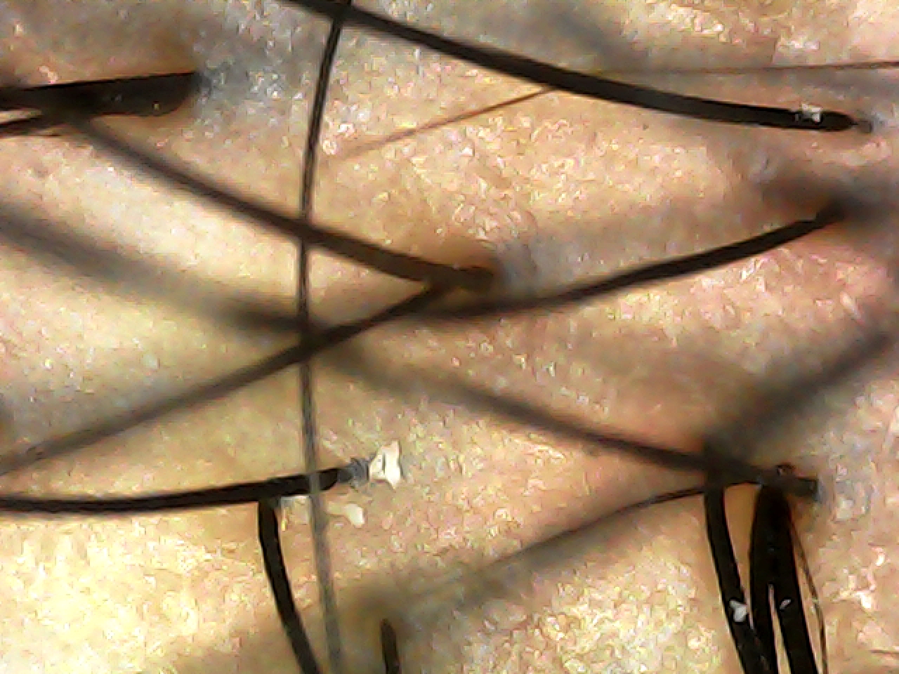 case03-khund-05-scope-after-2