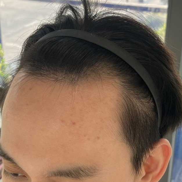 case04-khunv-01-before-1