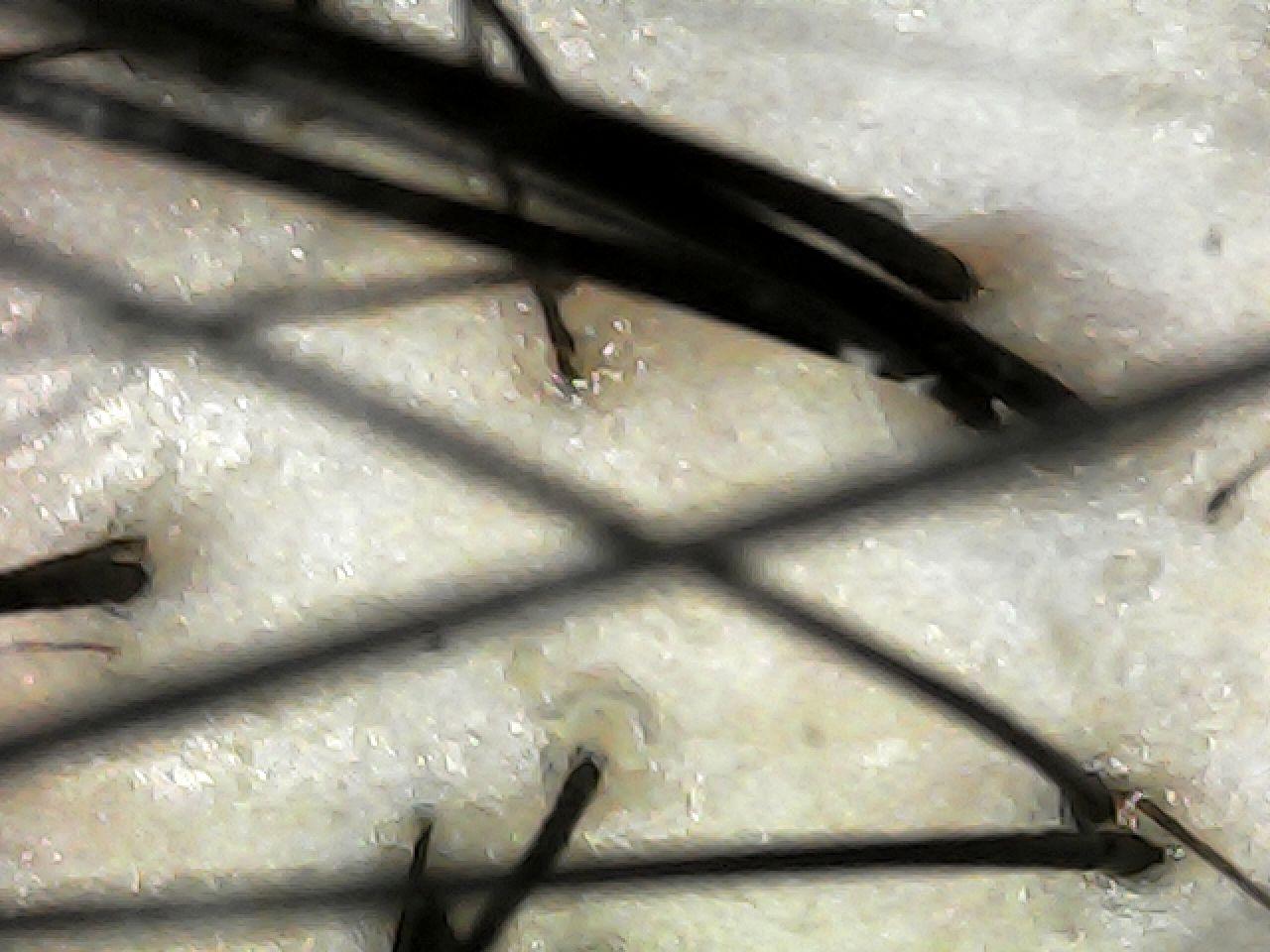 case04-khunv-06-scope-after-1