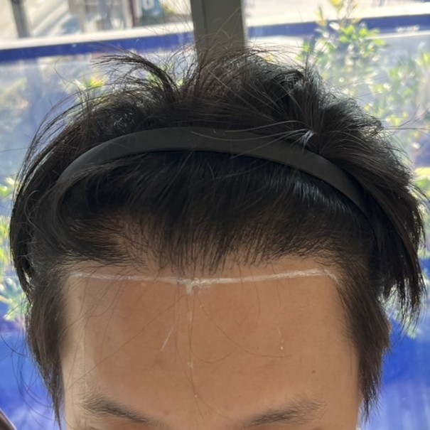 case06-khunk-01-before-1