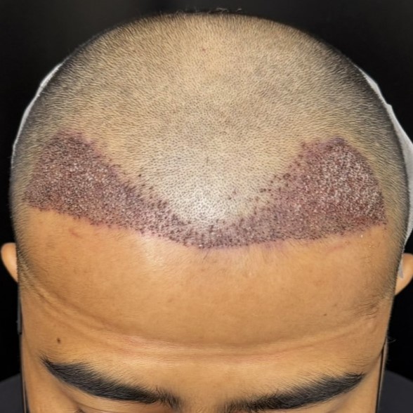 case08-khunf-03-after-immediate-1