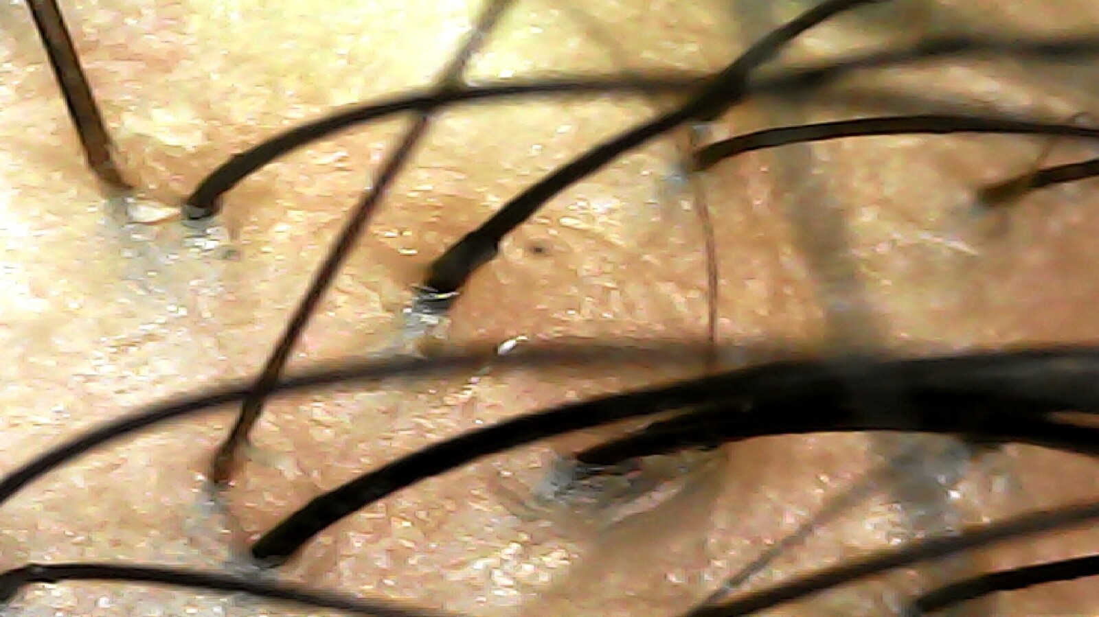 case08-khunf-06-scope-after-1