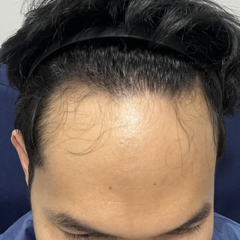 case09-khuns-01-before-1