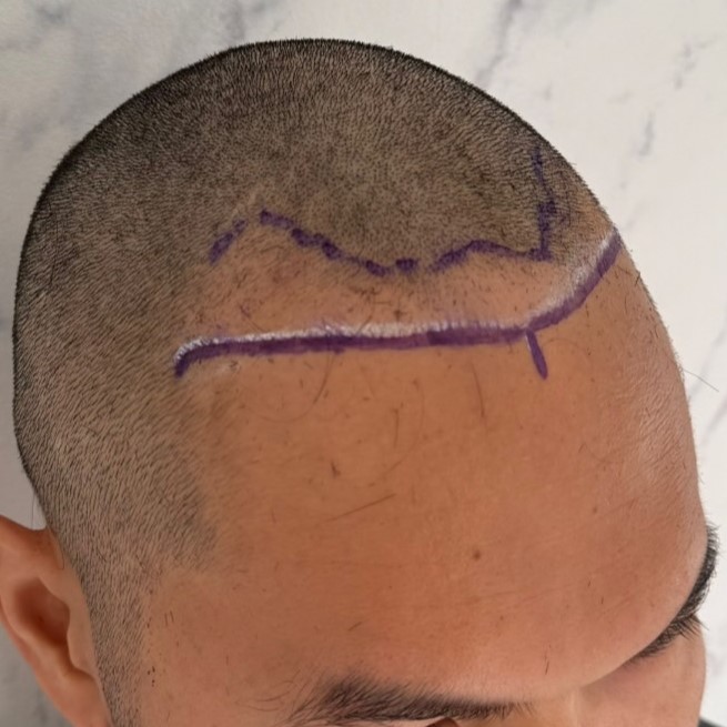 case09-khuns-02-surgery-day-3