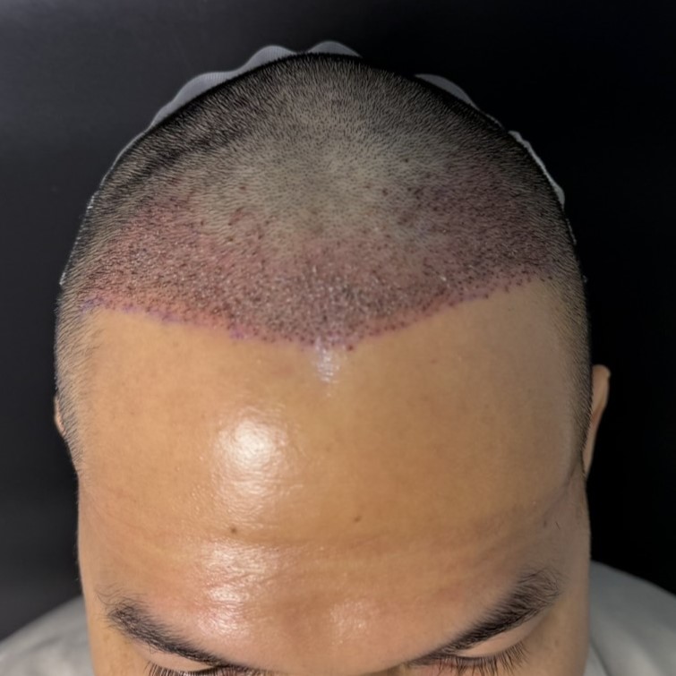 case09-khuns-03-after-immediate-1