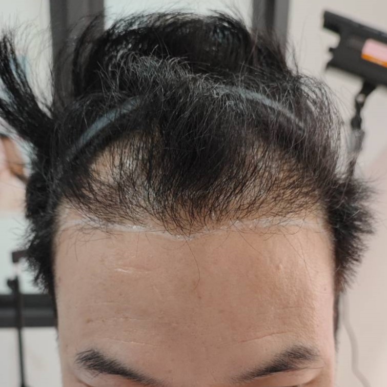 case10-khunka-01-before-1