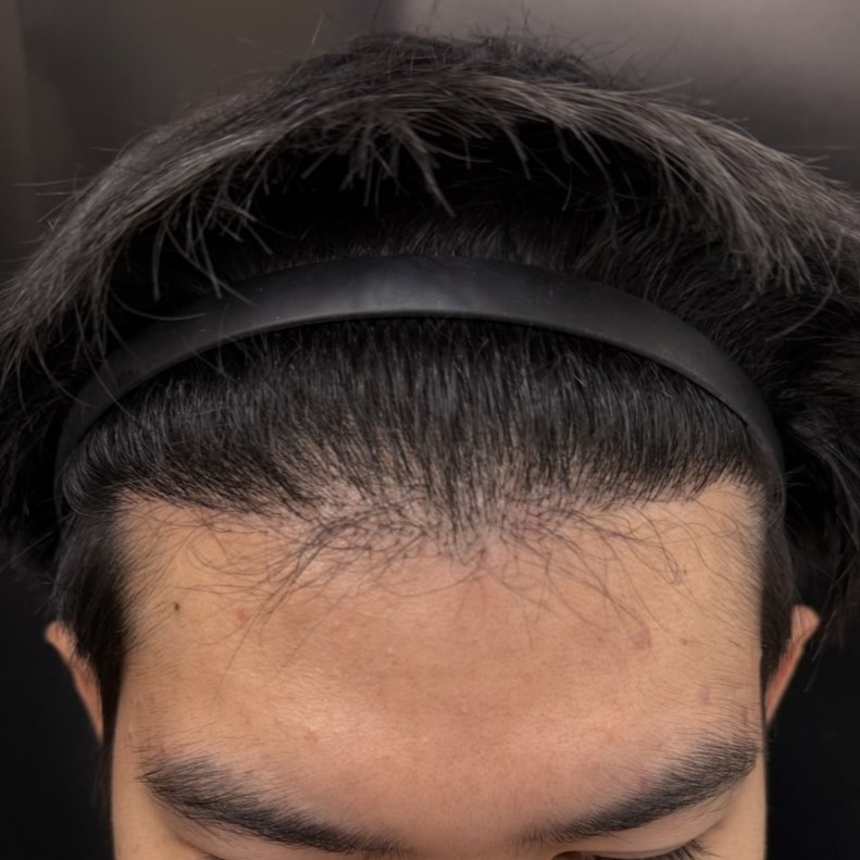 9_0