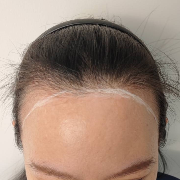 case13-khunp-01-before-1