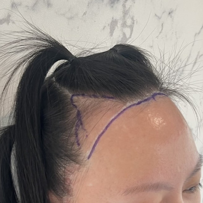 case13-khunp-02-surgery-day-3