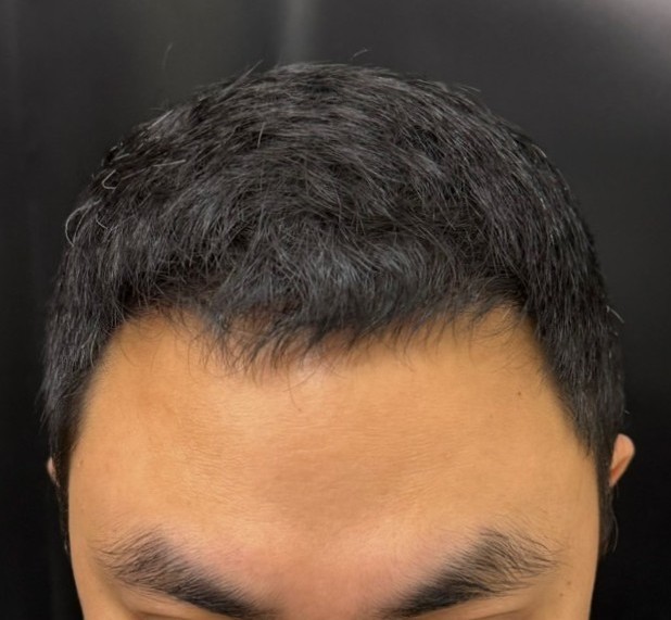 9_0