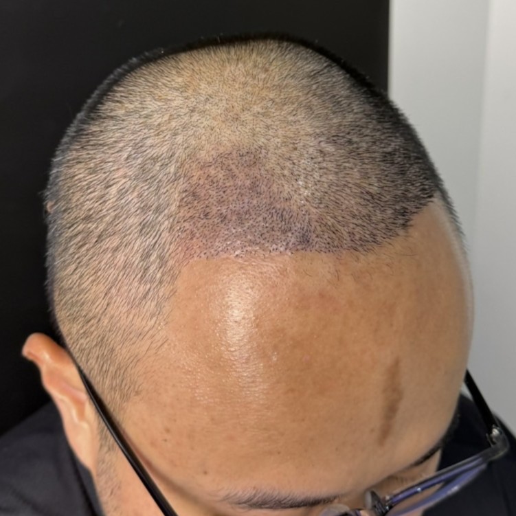 case19-khunam-03-after-14d-3