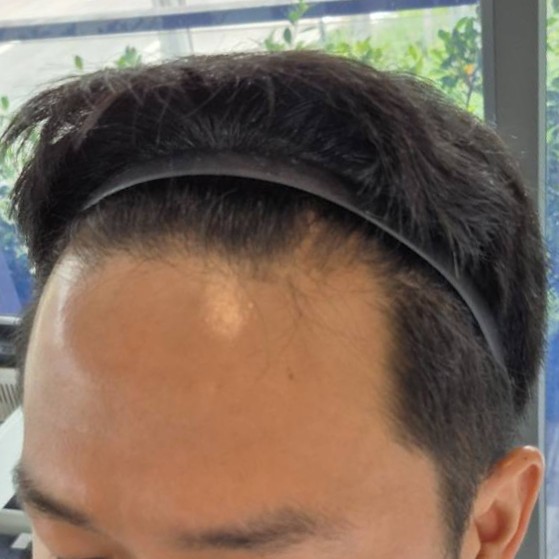 9_0