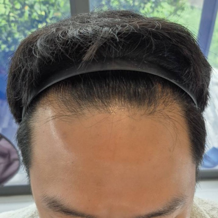 case23-khunch-01-before-2