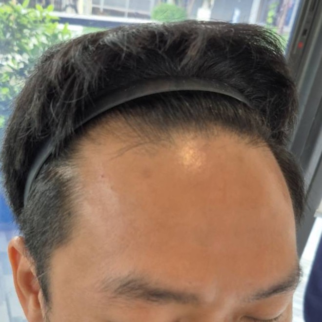 case23-khunch-01-before-3