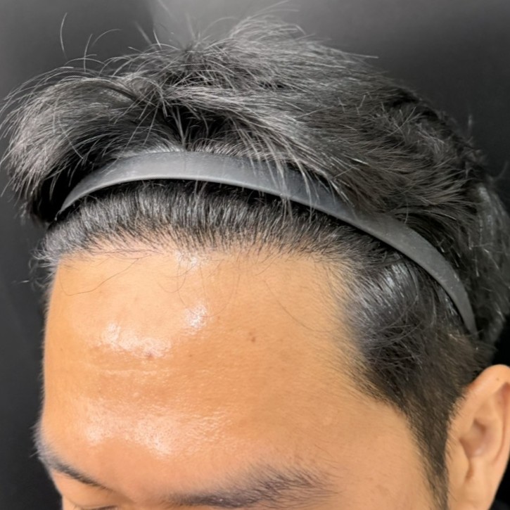 case23-khunch-05-result-1
