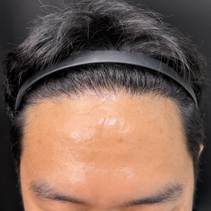 case23-khunch-05-result-2