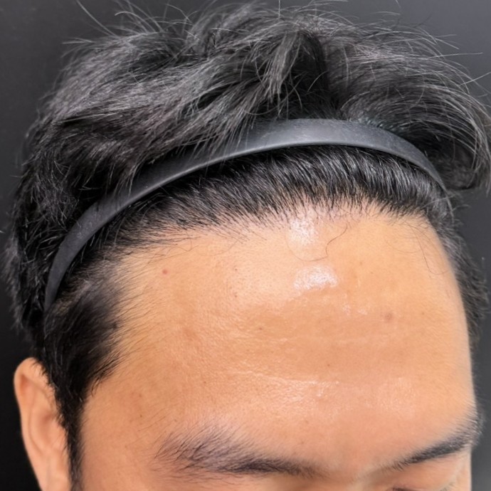 case23-khunch-05-result-3