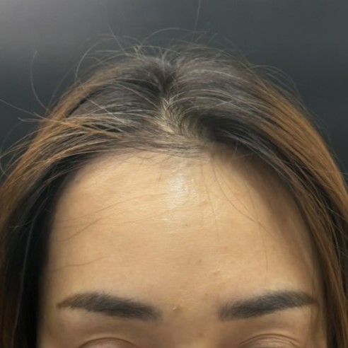 case24-khuntm-02-after-immediate-1