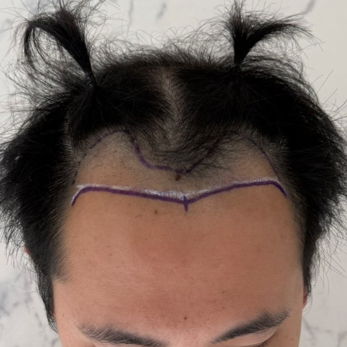 case28-khunan-01-surgery-day-2