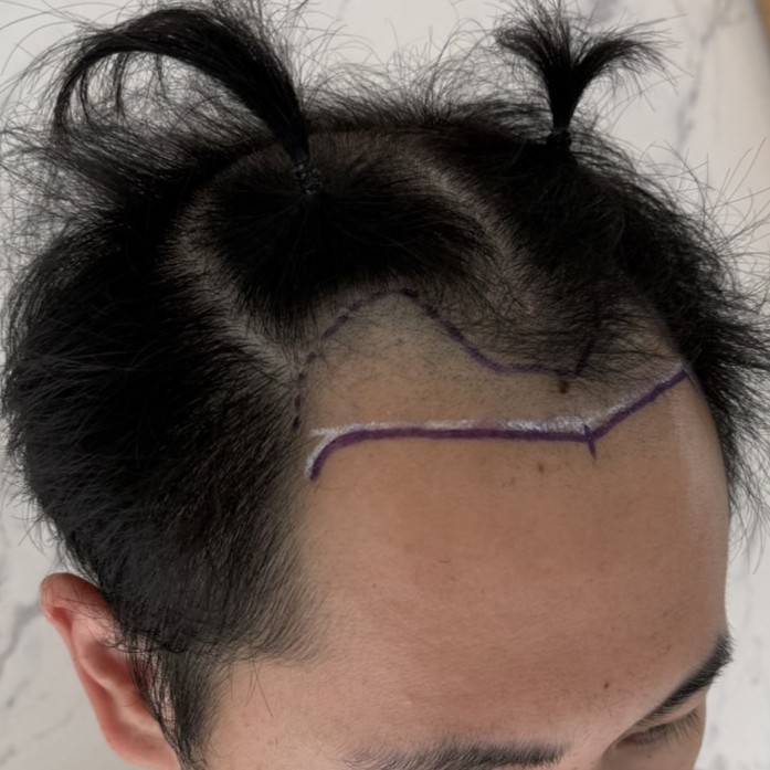 case28-khunan-01-surgery-day-3