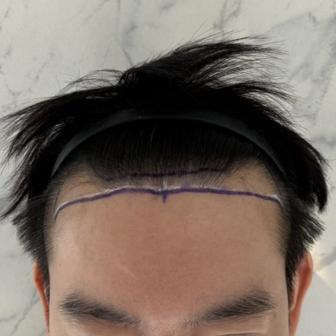 case29-khuntp-02-surgery-day-2