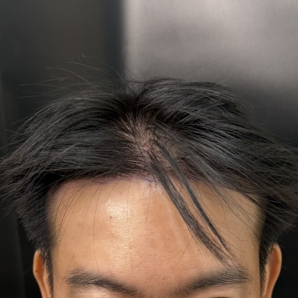 case29-khuntp-03-after-immediate-1