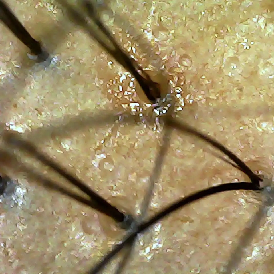 Case01 Khunaa 02 During Scope