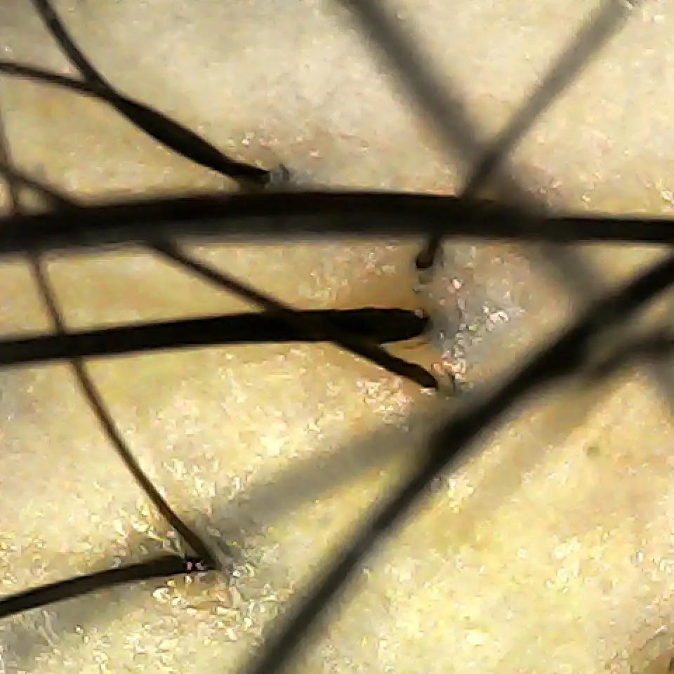 Case02 Khunbb 02 During Scope