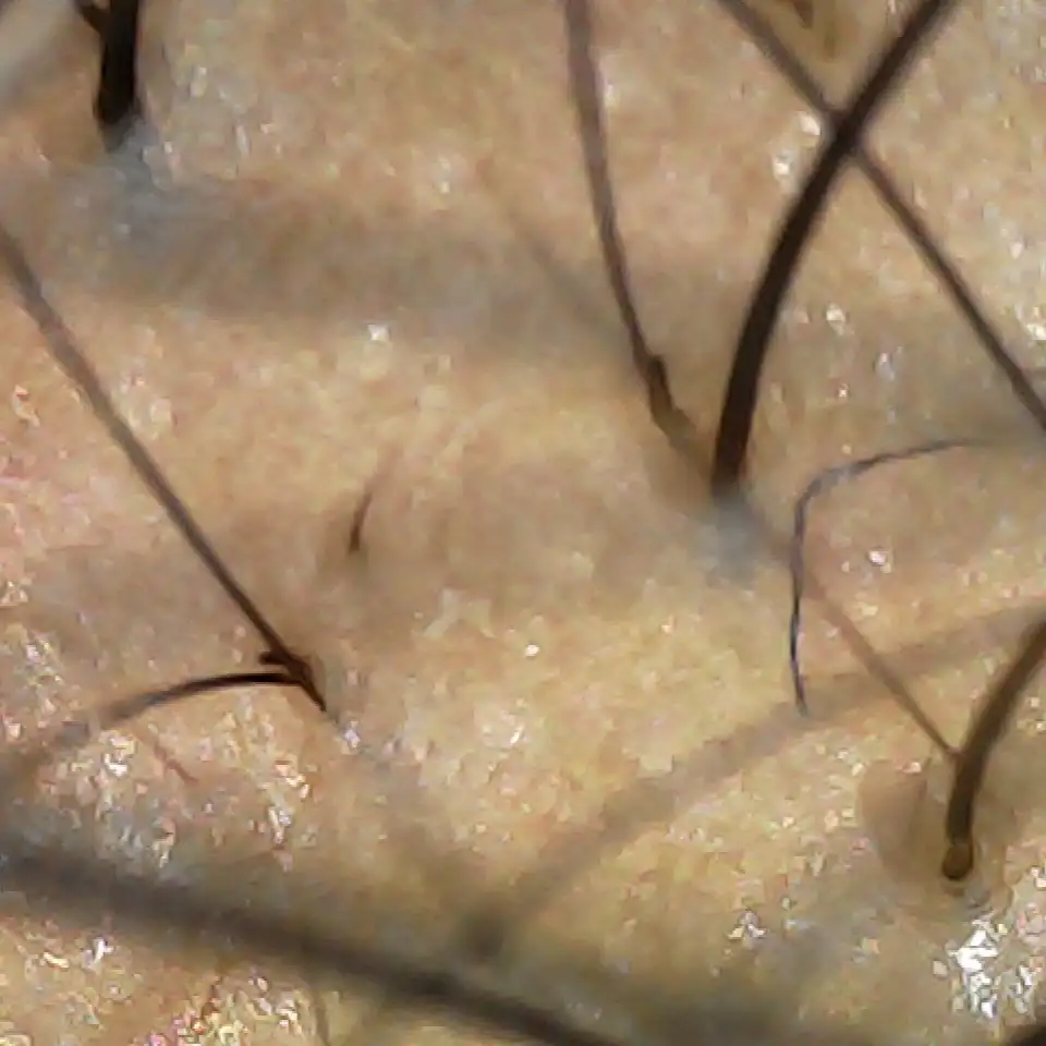 Case03 Khundd 01 Before Scope