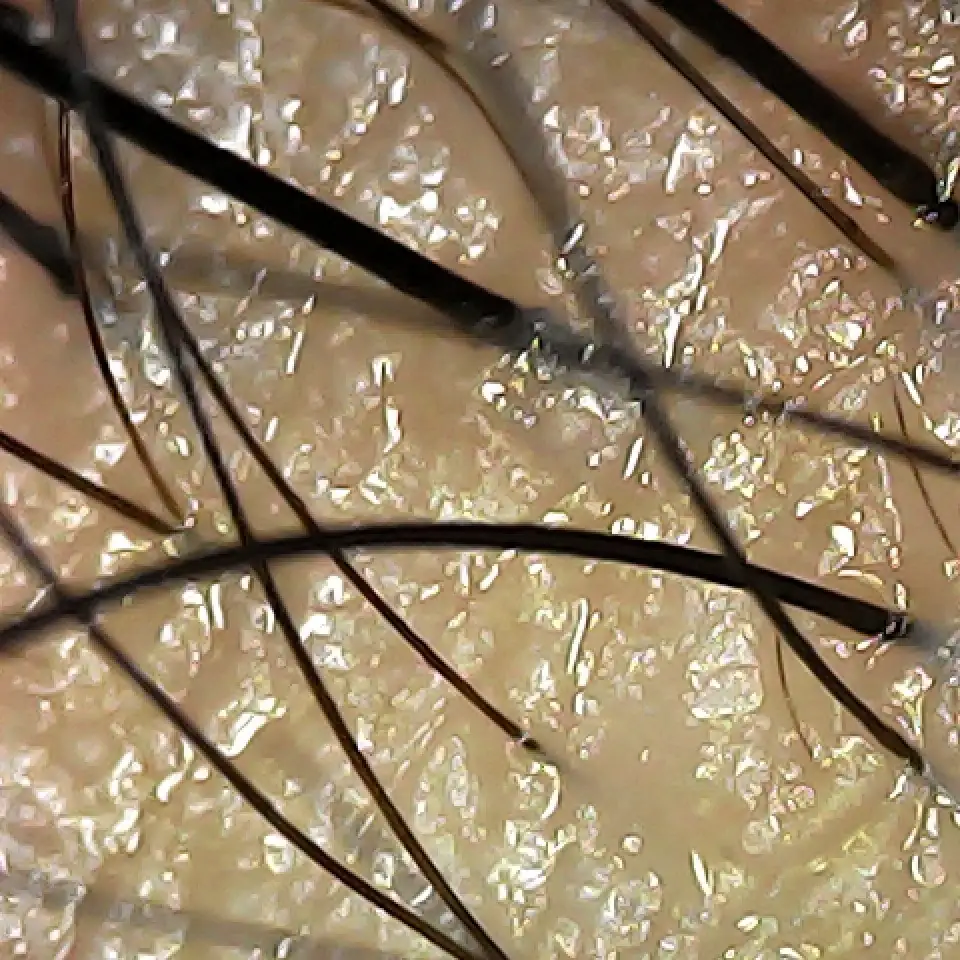 Case03 Khundd 02 During Scope