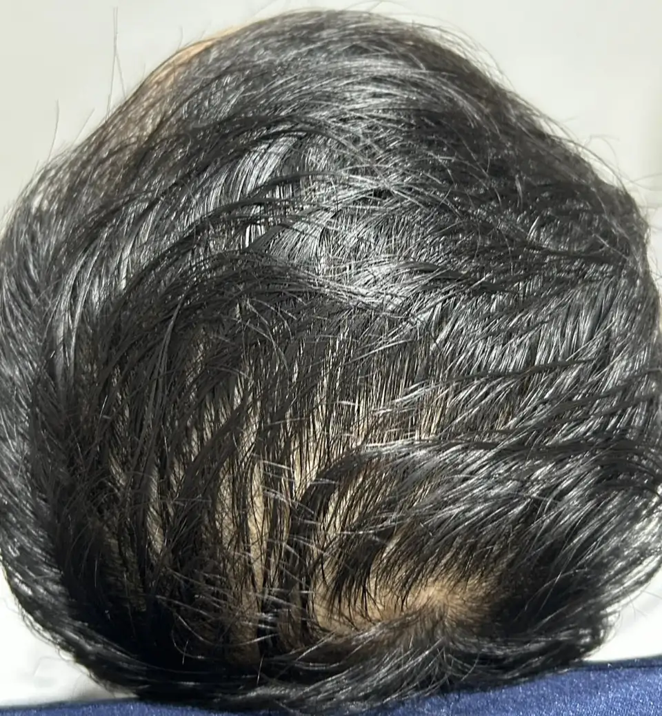 Case04 Khunee 02 During
