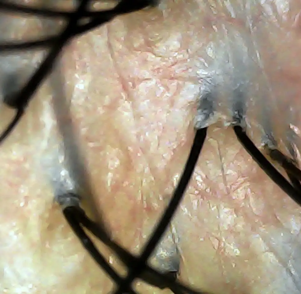 Case04 Khunee 03 Result Scope