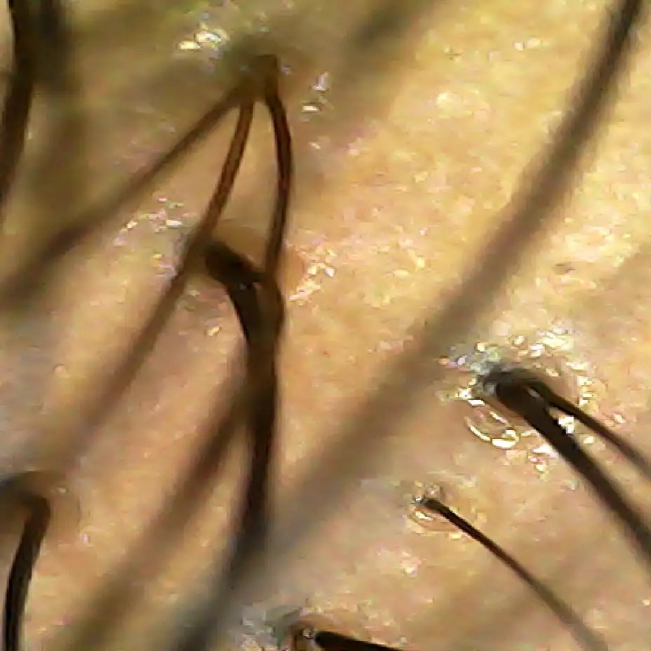 Case06 Khungg 02 During Scope