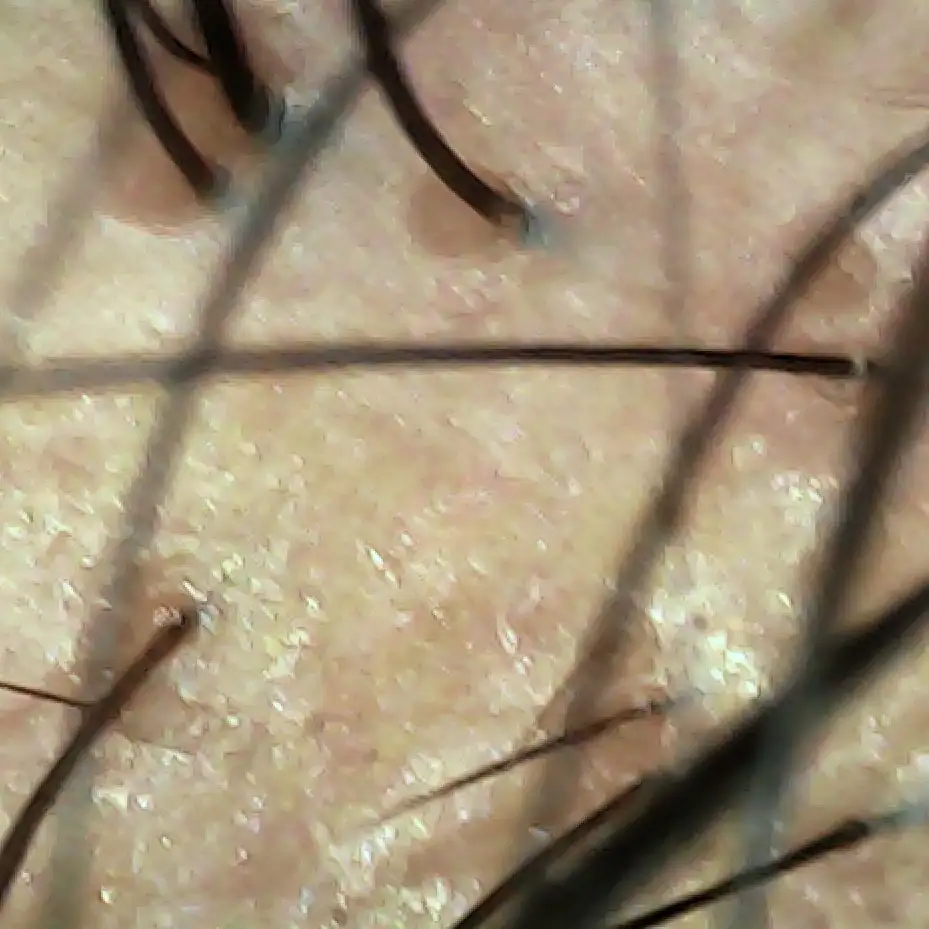 Case07 Khunhh 02 During Scope