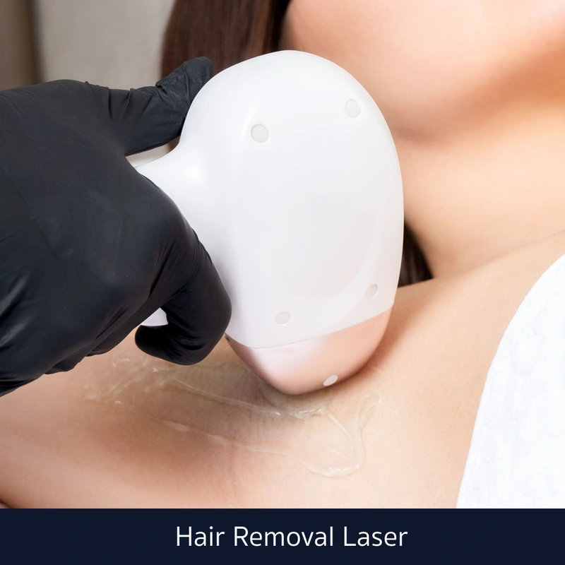 Hair Removal Laser