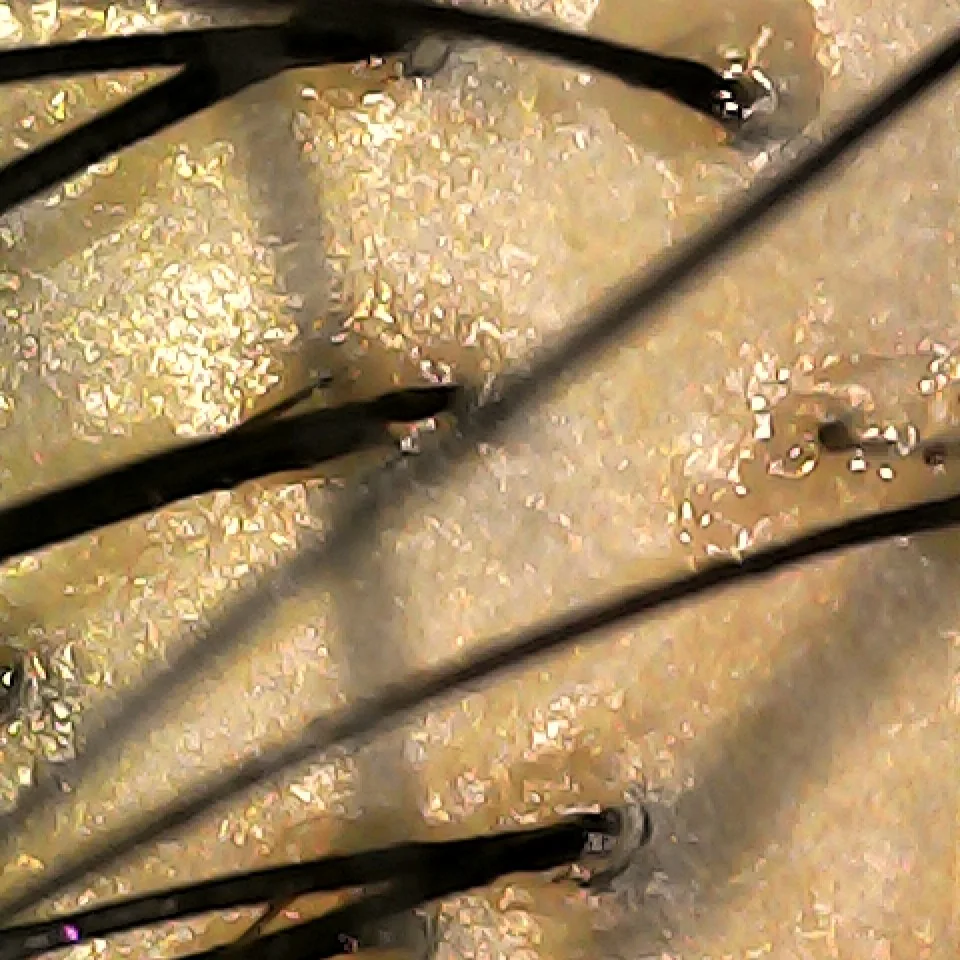 ht-05-trichoscope-root